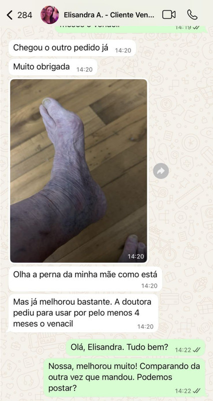 Print WhatsApp cliente creme para varizes