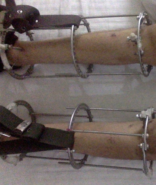 Fixator