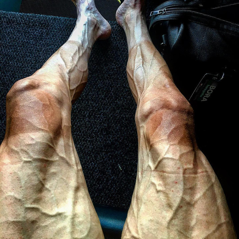 Cyclist-Poljanski-s-legs-after-Tour-De-France
