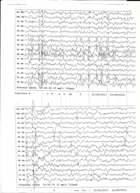 сканирование0006