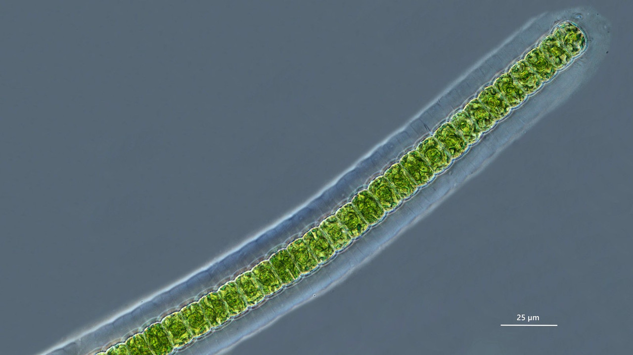 Hyalotheka 03 dissilens Glashüllen-Alge Giglachsee PH  50