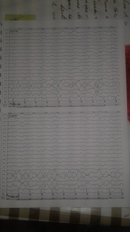 15105229278741287644101