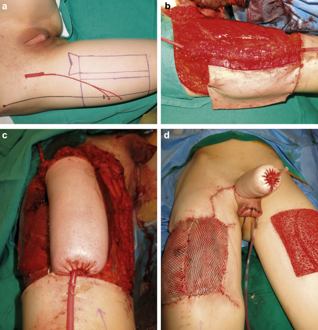 ftm penis leg sausage