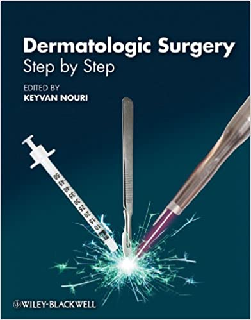 Dermatologic Surgery Step by Step