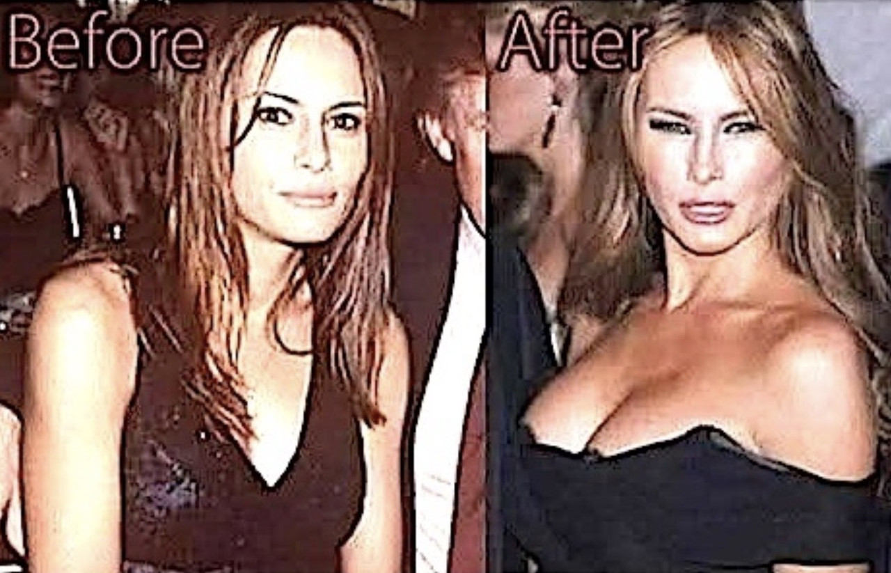 OMG