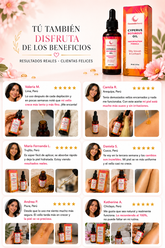 Imagen personalizada