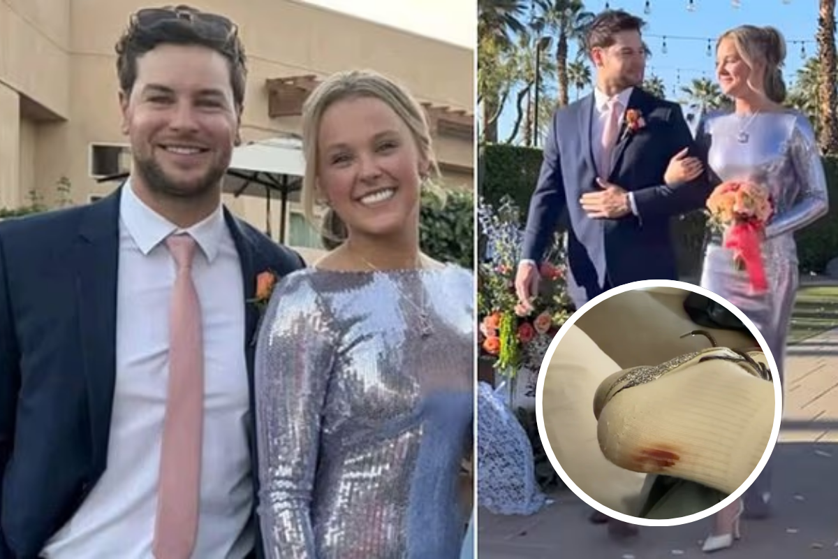 JoJo Siwa reveals the painful aftermath of wedding makeover after walking down the aisle with Chris Hughes