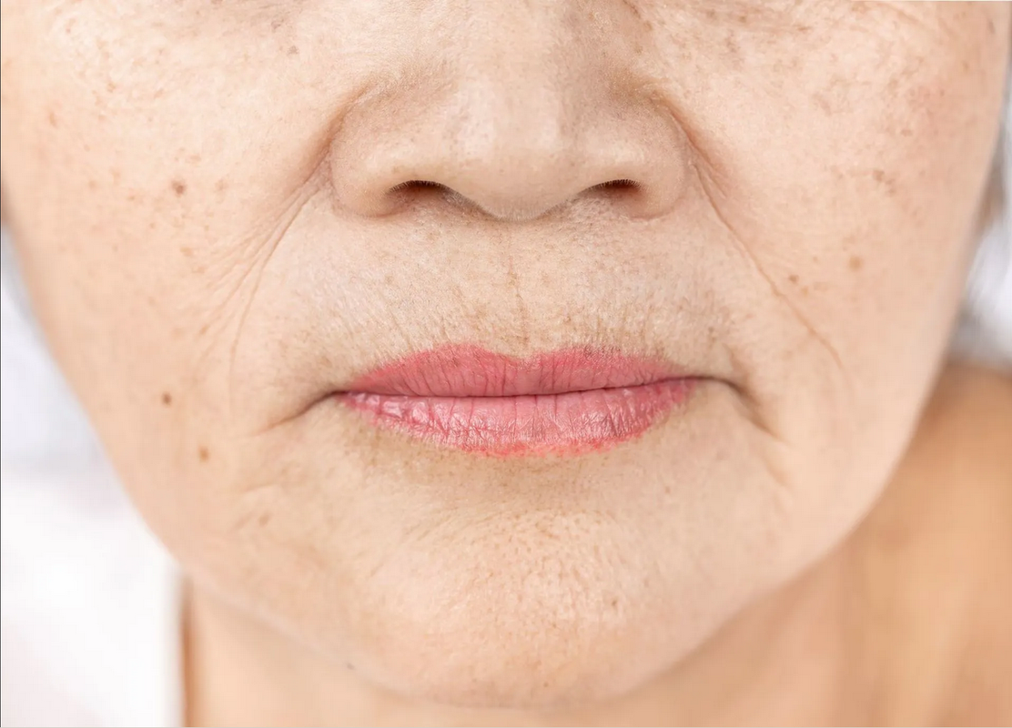 ¿Cómo quitar las arrugas de la boca de forma natural?