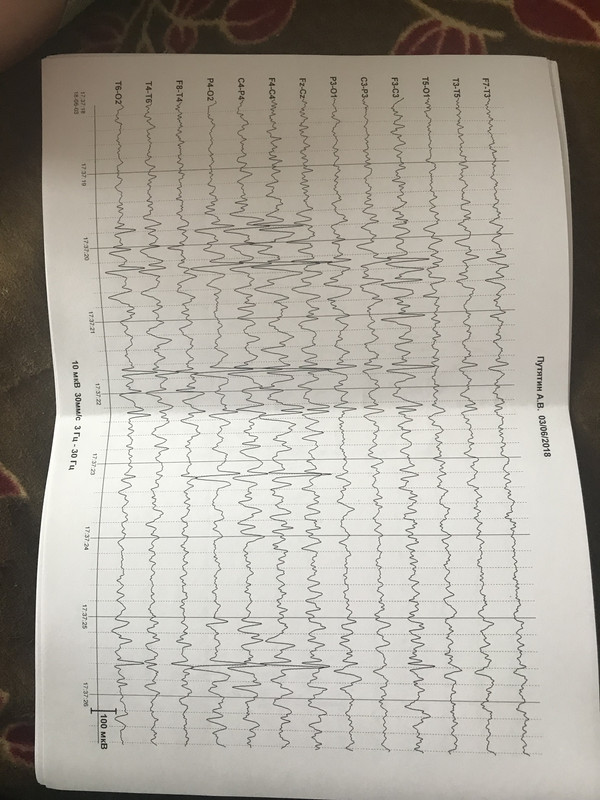 72A007D8-6129-4316-AE50-0FFA193DB298