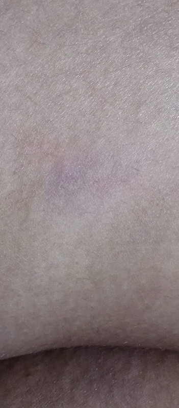 the same feb 25 spot but taken today