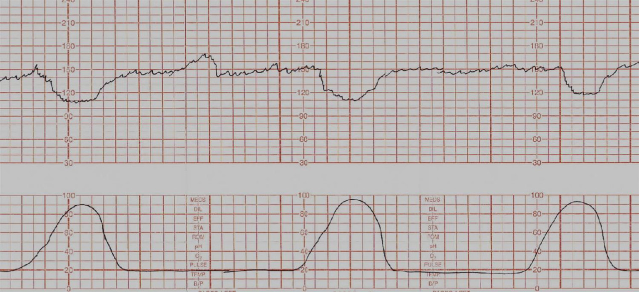 Obstetrics question 4 image