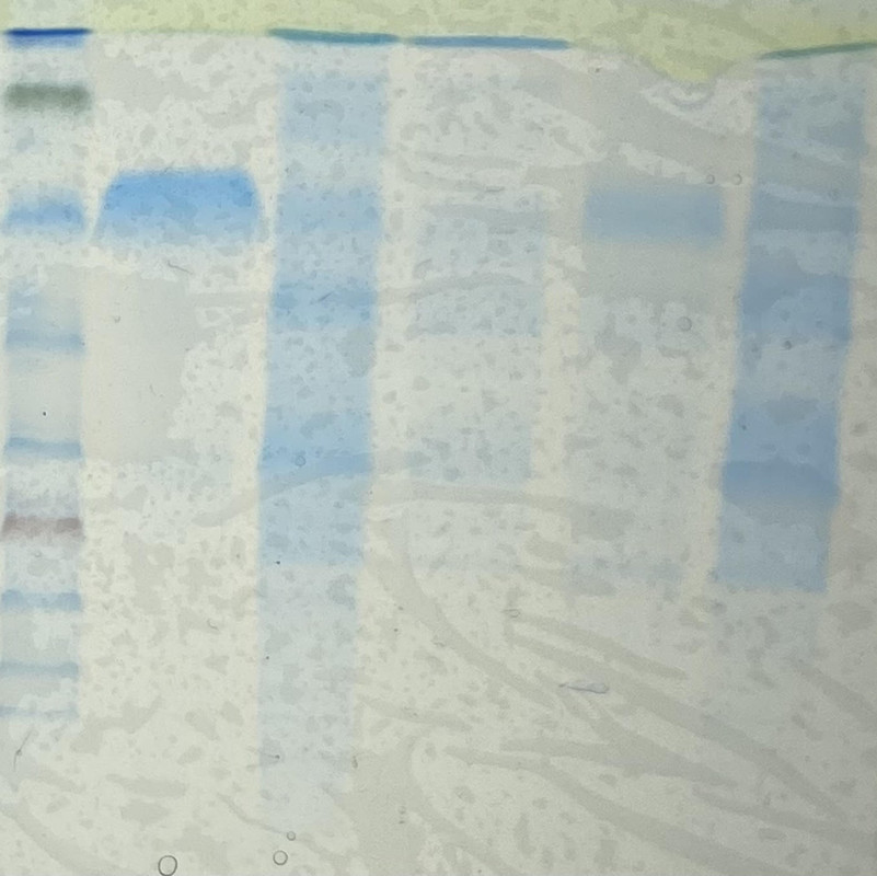 SDS PAGE (Biochem Exp)