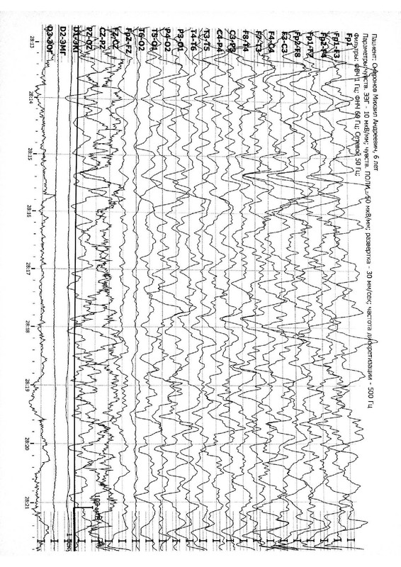 963873294b80479d965a30243f1151787COgqKfaoS7IG2sk-3