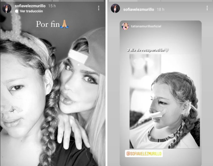 Mujer adicta a las cirugías festeja que su hija de 12 años se operó por primera vez