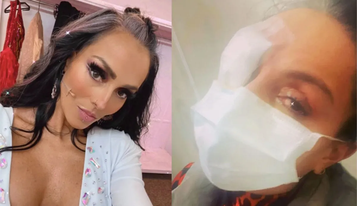 Ivonne Montero rompe el silencio y revela si es que quedará ciega de por vida