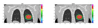 Figure 2: Example of TRiP and RIDOS dose distributions in a coronal slice.Gamma-analysis passing rate (3mm/3%)>98%.