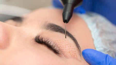 Plasmapen-Fibroblast treatment for aestheticians