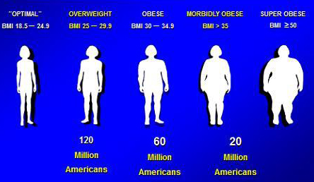 obese.jpg