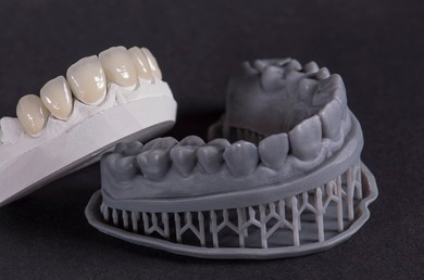 Coroas sobre Implante