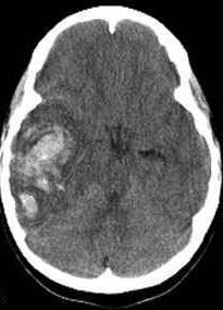 Neurology question 5 image
