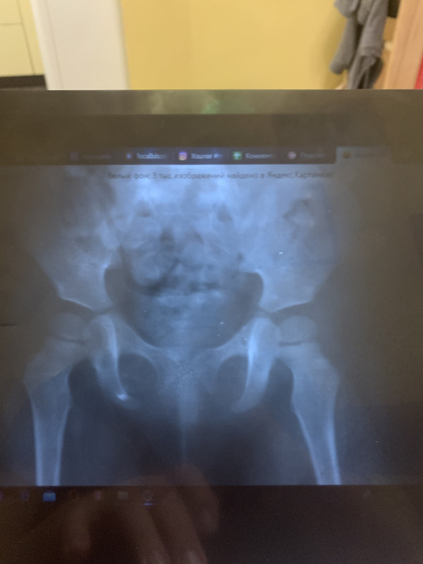 A2674FDB-E706-4060-BADE-C71AB141FEDC