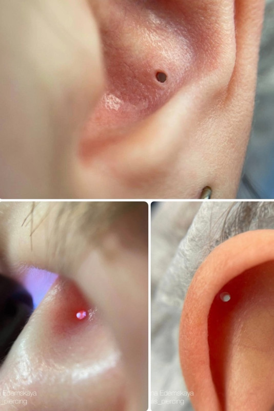 Screenshot_20221129-093430_Telegram