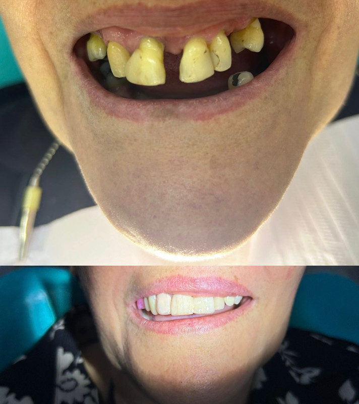 Harmonização do Sorriso