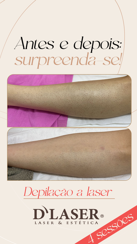 Antes e Depois 2