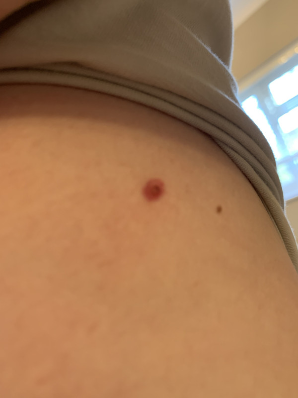 543BBB67-164A-4D42-ABC7-3DC70F8241FC