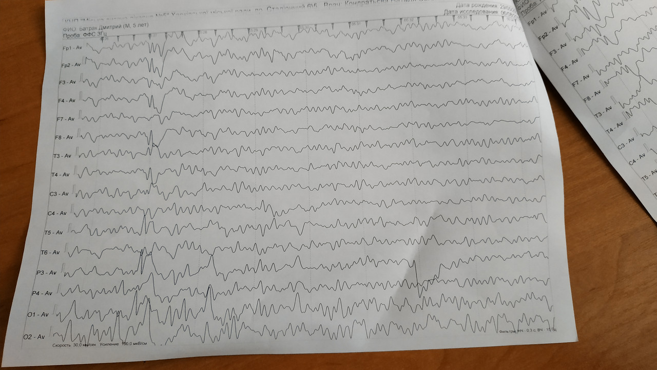 Делают ээг год. Направление на ЭЭГ. ЭЭГ при эпилепсии. Энцефалопатия на ЭЭГ. ЭЭГ при энцефалопатии.
