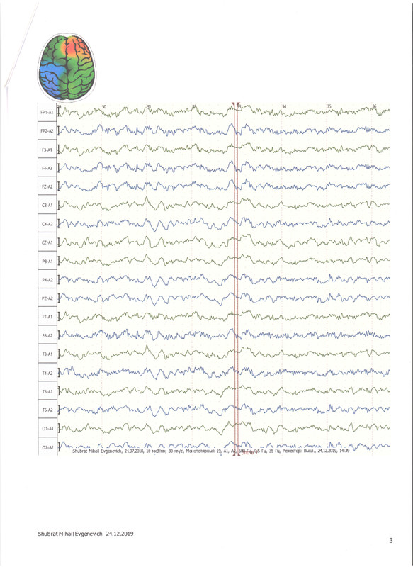 ЭЭГ 24.12.19 3.jpeg