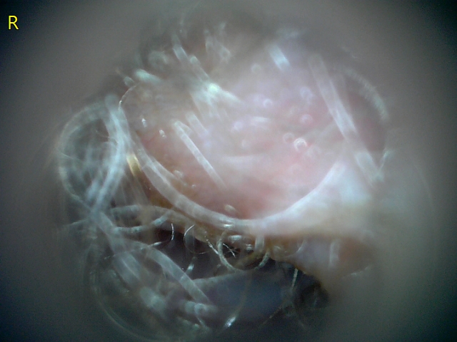 23207 177218 Into CNS 000011