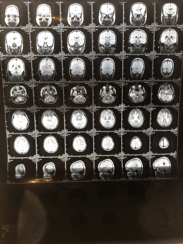 ADADAA0E-DC65-4EE0-BFEB-1648453B05E9