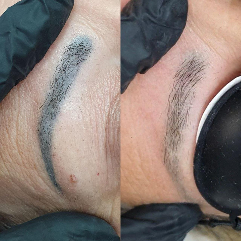 Trabalho de micropigmentação 4