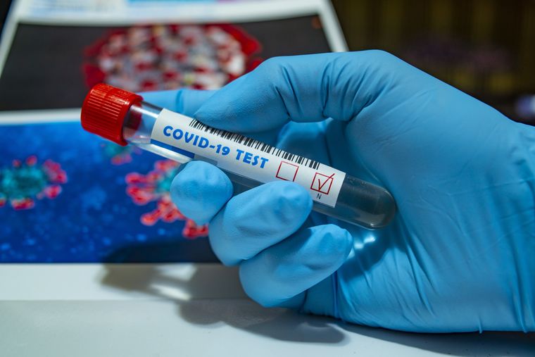 COVID 19 blood test
