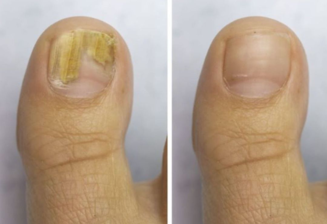 Depoimento cliente Micovax