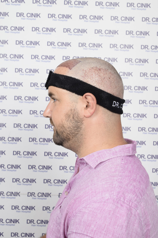 photos postopératoires (4)