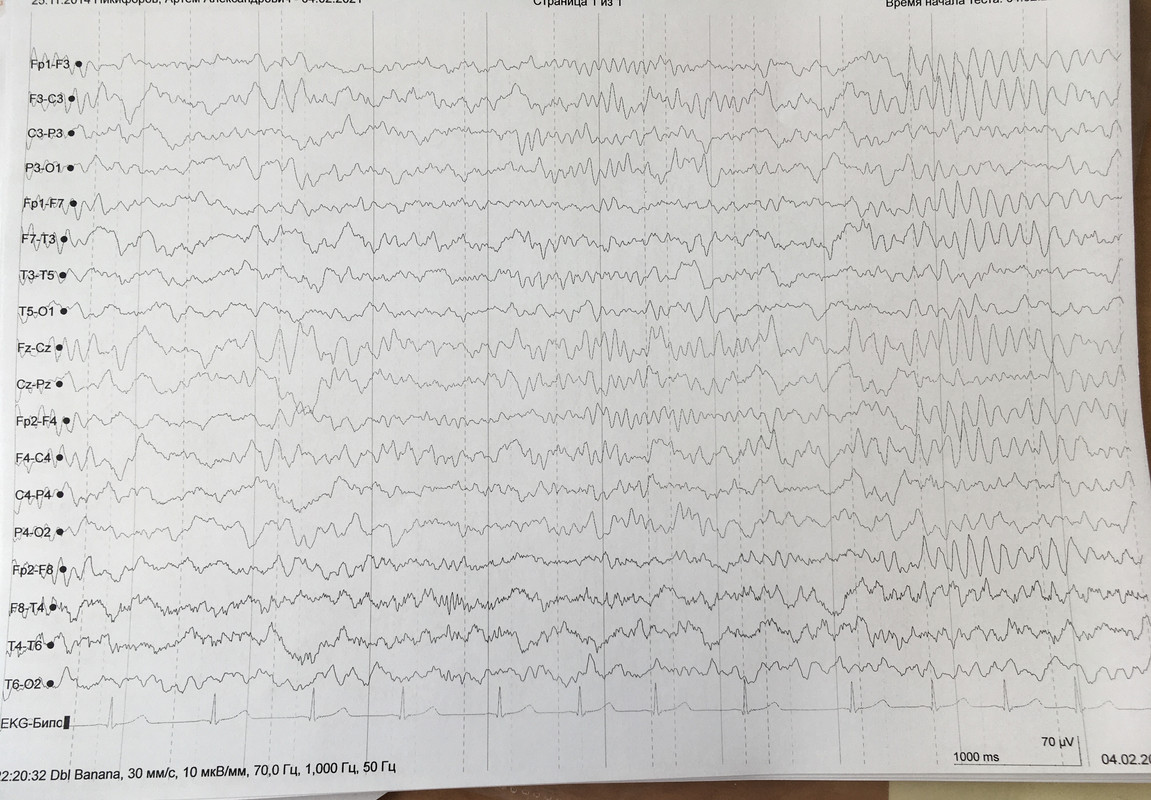 A69A23BE-7A70-4889-9F4E-8620FBD6A389