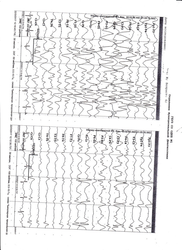 ЭЭг лист4от 03.17