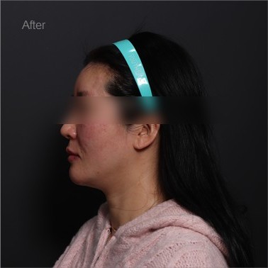 Post-Treatment Clinical State