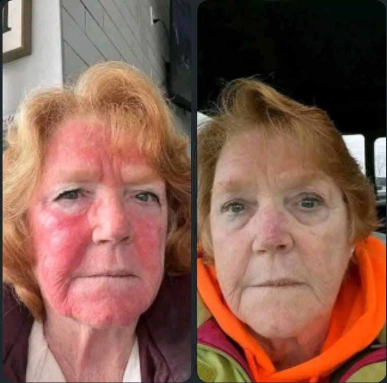 Maria S. before and after