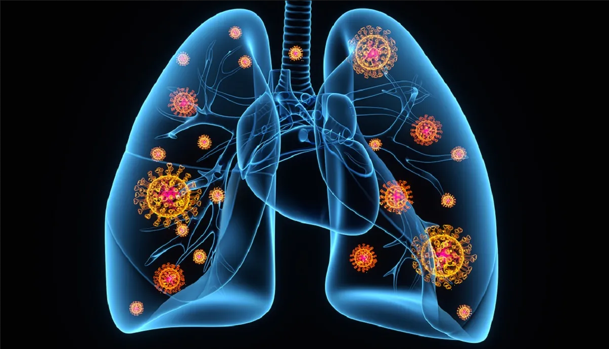 Estudio revela que el Covid-19 puede causar daños a largo plazo en órganos