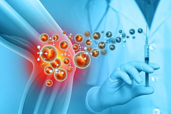 Stem Cell Tampa Florida