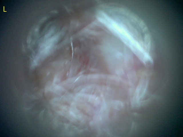 23207 177211 Into CNS 000004