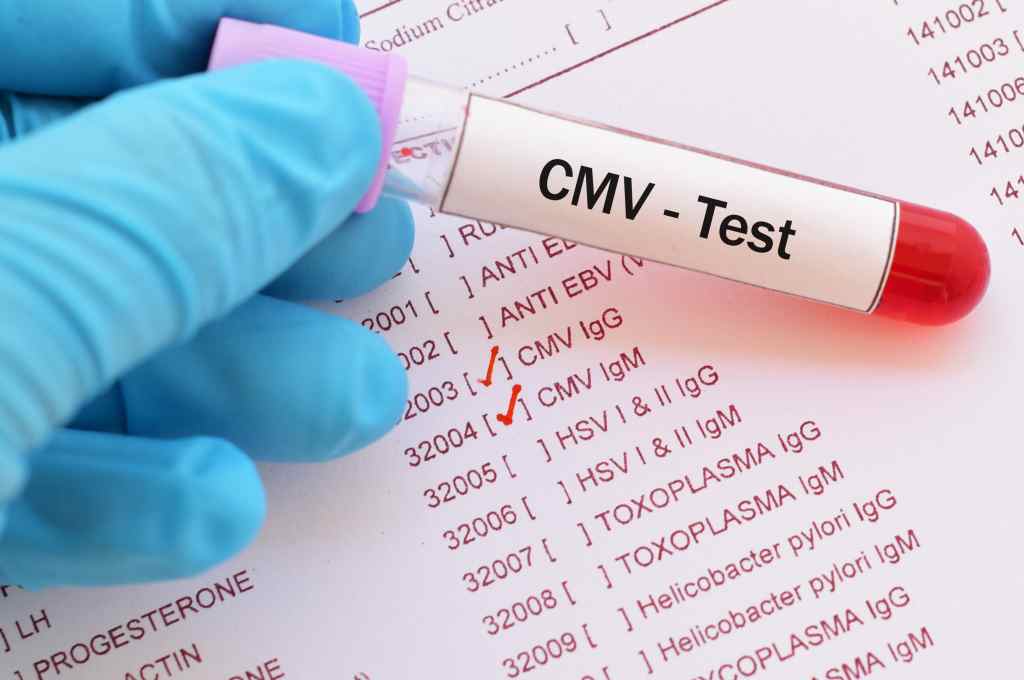 Cytomegalovirus (CMV)