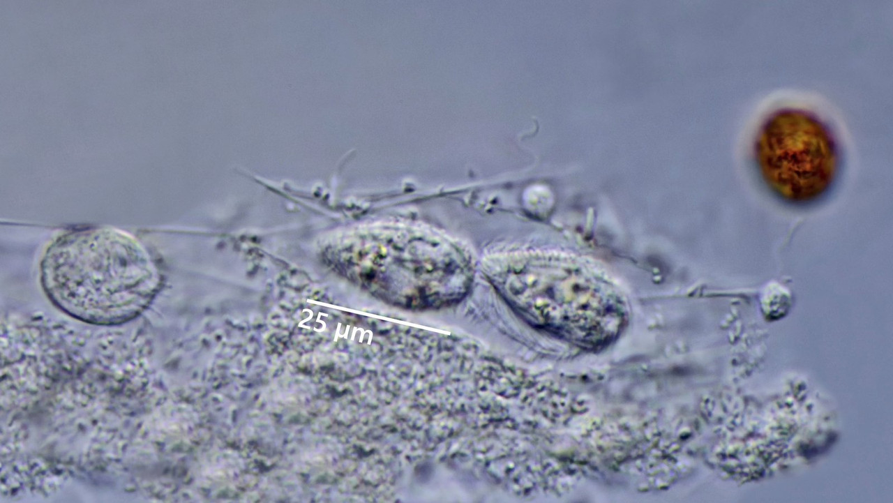 Calyptotricha 01 lanuginosa Röhrentier Oralapparat Doppelmenbran DIK 100 FOISS 3-288