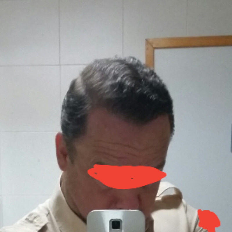 2018-08-17 08.37.29