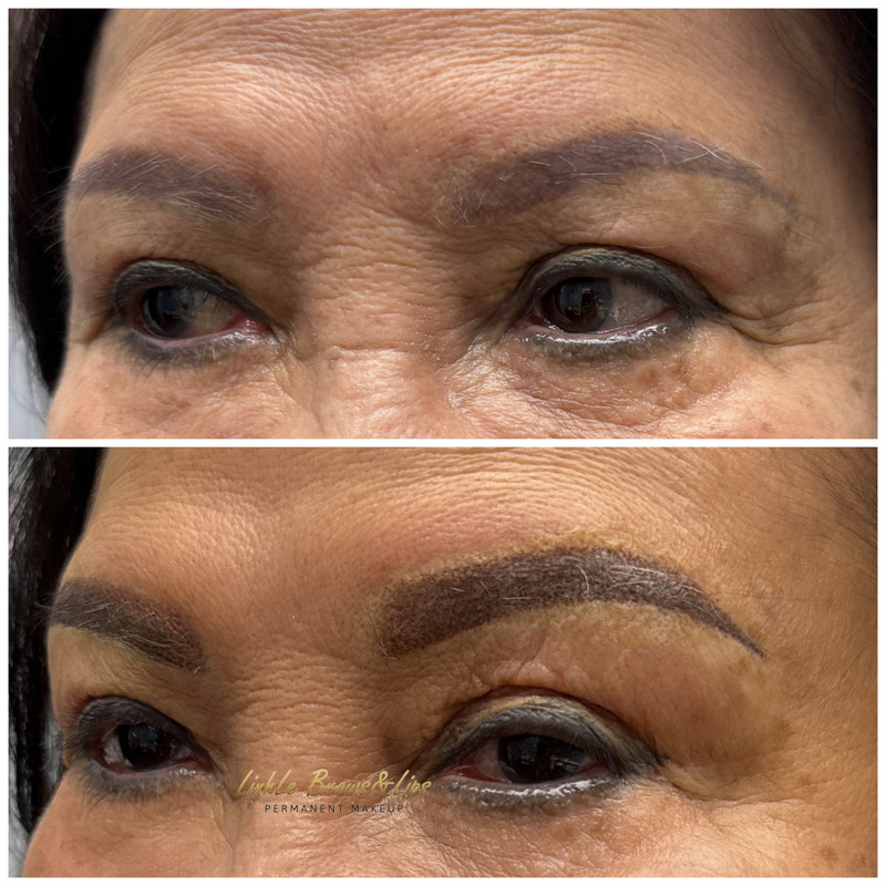 Eyebrow Enhancement Example 6