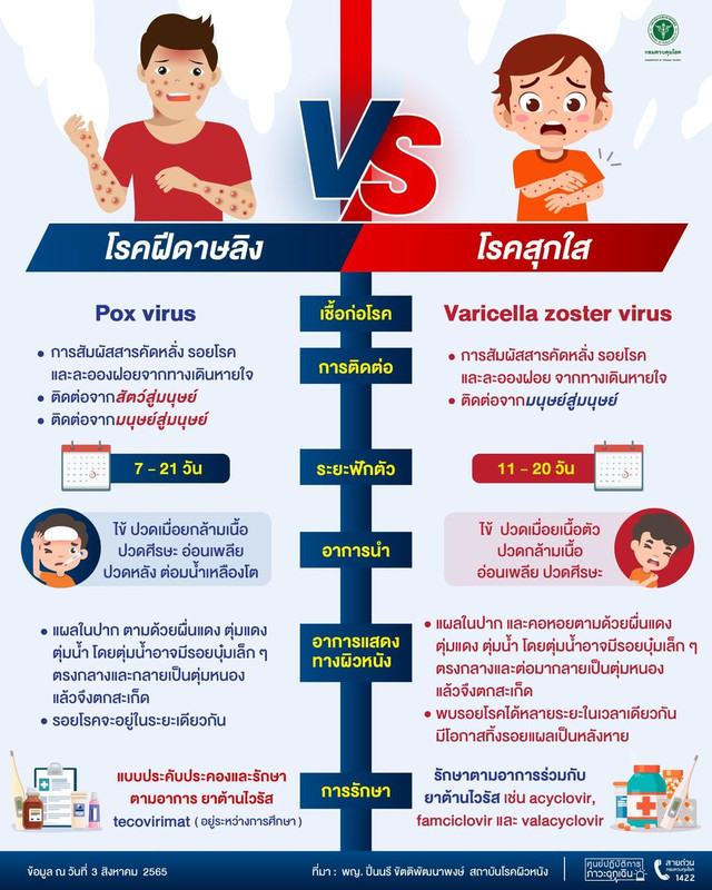 ความแตกต่างของ "โรคฝีดาษลิง" กับ "โรคสุกใส"
