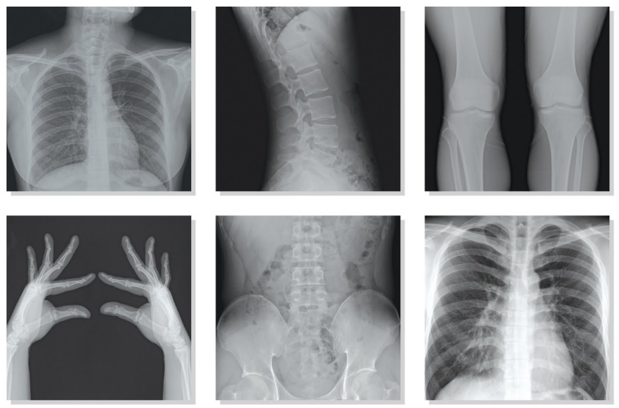 Imagen Diagnóstica Radiología Musculoesquelética
